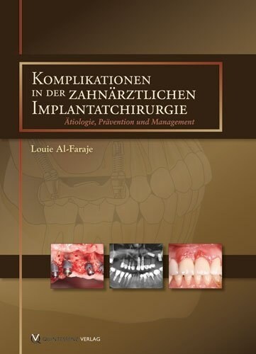 Komplikationen in der zahnarztlichen Implantatchirurgie (Hardcover)