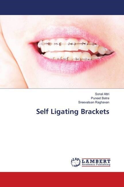 Self Ligating Brackets (Paperback)