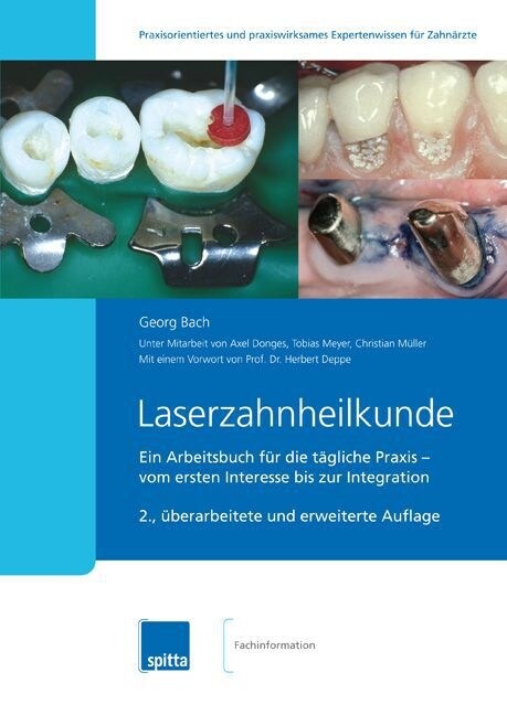 Laserzahnheilkunde (Paperback)