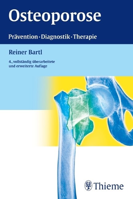 Osteoporose (Paperback)