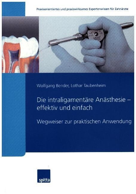 Die intraligamentare Anasthesie - effektiv und einfach (Paperback)
