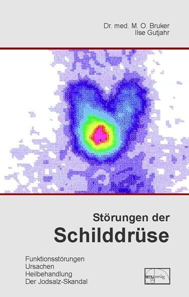 Storungen der Schilddruse (Hardcover)