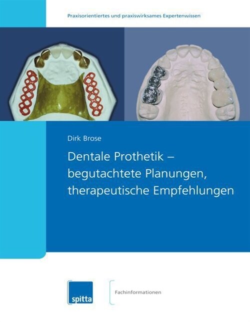 Dentale Prothetik - begutachtete Planungen, therapeutische Empfehlungen (Paperback)