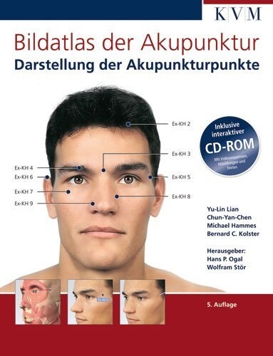 Bildatlas der Akupunktur, m. CD-ROM (Hardcover)