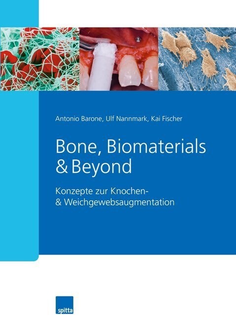 Bone, Biomaterials & Beyond (Hardcover)