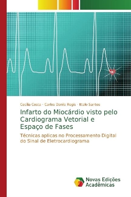 Infarto do Mioc?dio visto pelo Cardiograma Vetorial e Espa? de Fases (Paperback)