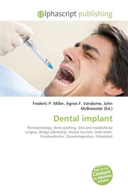 Dental implant (Paperback)