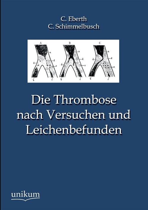 Die Thrombose nach Versuchen und Leichenbefunden (Paperback)