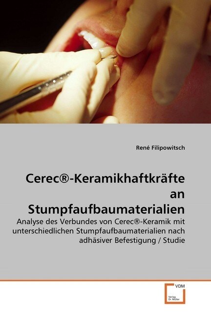 Cerec®-Keramikhaftkrafte an Stumpfaufbaumaterialien (Paperback)