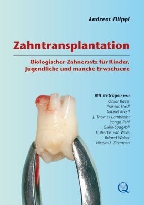 Zahntransplantation (Hardcover)