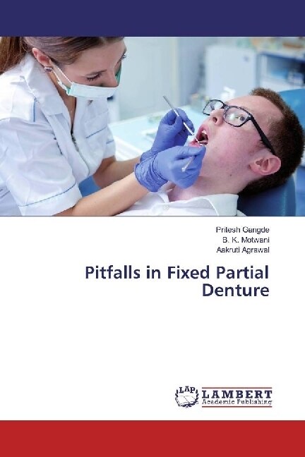 Pitfalls in Fixed Partial Denture (Paperback)