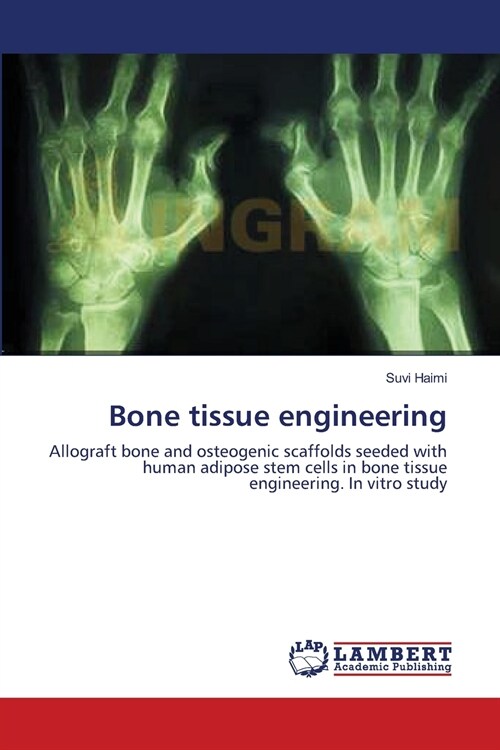 Bone tissue engineering (Paperback)