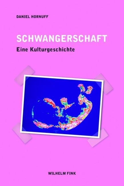 Schwangerschaft (Paperback)