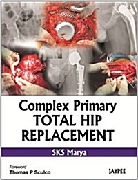 Complex Primary Total Hip Replacement (Hardcover)
