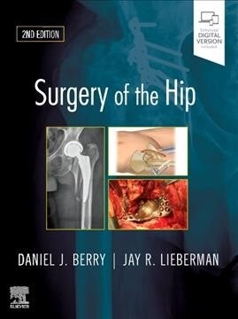 Surgery of the Hip (Hardcover, 2)