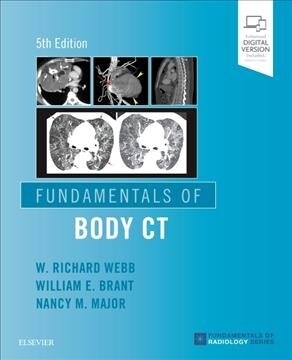 Fundamentals of Body CT (Paperback, 5)