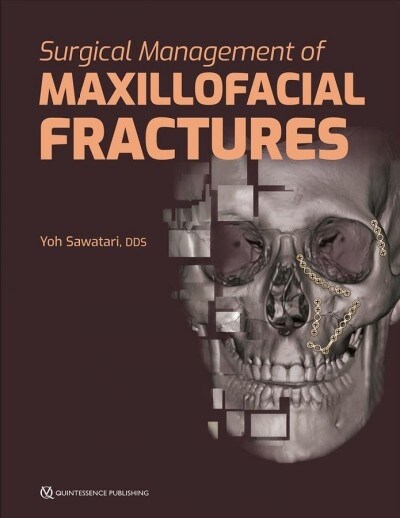 Surgical Management of Maxillofacial Fractures (Hardcover)