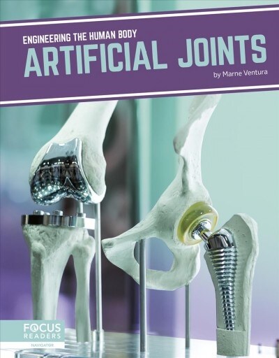 Artificial Joints (Library Binding)