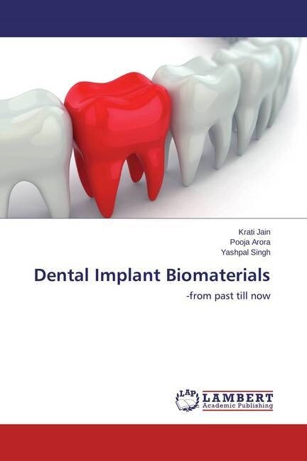 Dental Implant Biomaterials (Paperback)