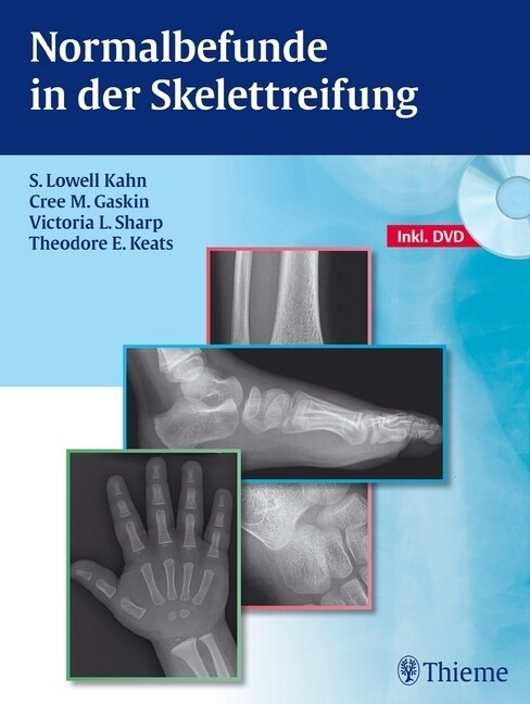 Normalbefunde in der Skelettreifung, m. DVD (Hardcover)