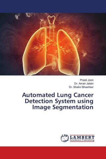 Automated Lung Cancer Detection System using Image Segmentation (Paperback)