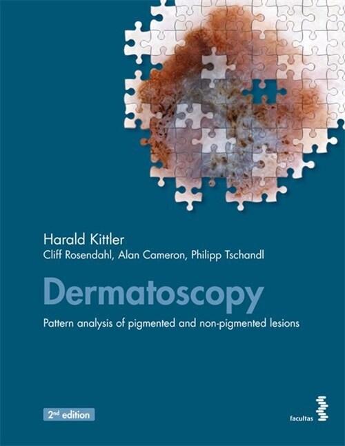 Dermatoscopy: Pattern analysis of pigmented and non-pigmented lesions (Paperback)