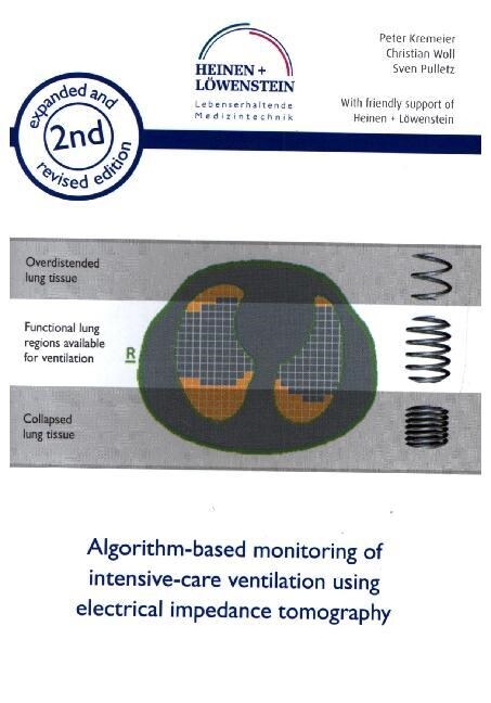 Algorithm-based monitoring of intensive-care ventilation using electrical impedance tomography (Paperback)