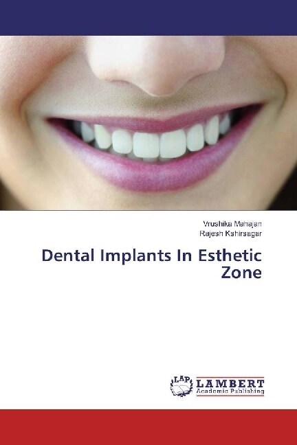 Dental Implants In Esthetic Zone (Paperback)