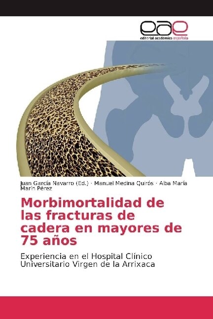 Morbimortalidad de las fracturas de cadera en mayores de 75 anos (Paperback)
