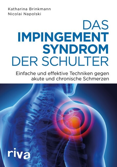 Das Impingement-Syndrom der Schulter (Paperback)