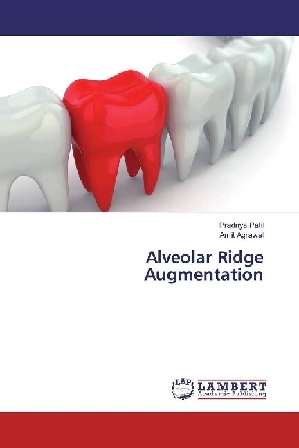 Alveolar Ridge Augmentation (Paperback)