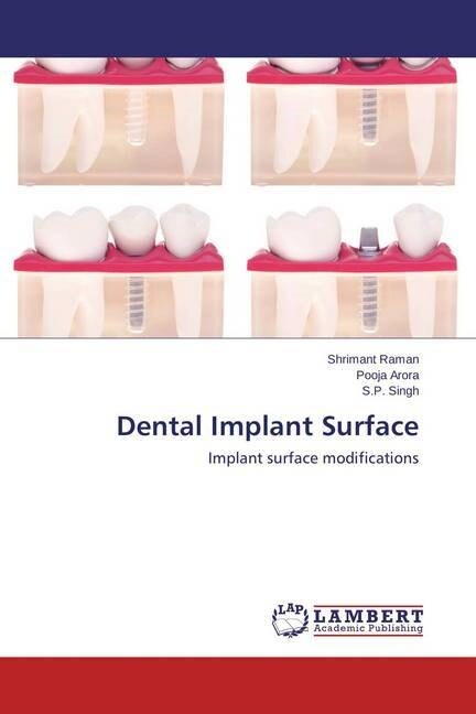 Dental Implant Surface (Paperback)