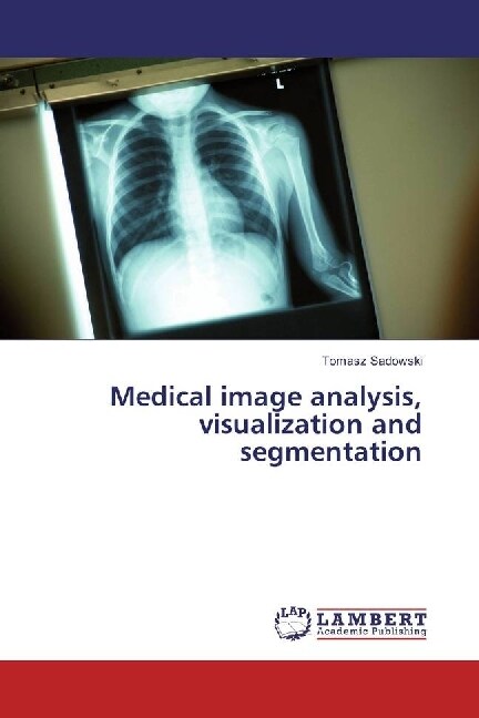 Medical image analysis, visualization and segmentation (Paperback)