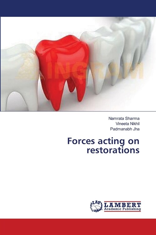 Forces acting on restorations (Paperback)