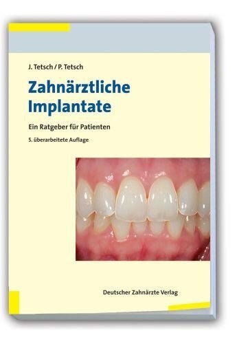 Zahnarztliche Implantate (Paperback)