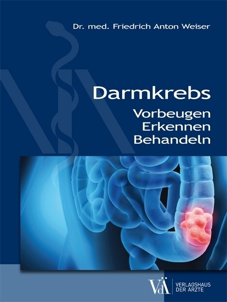 Darmkrebs (Paperback)