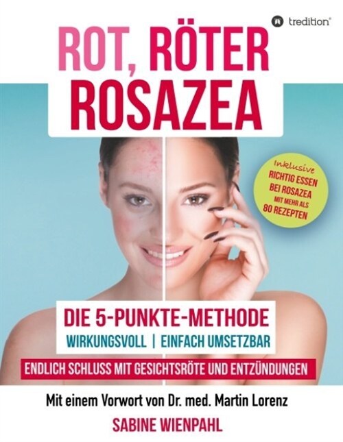 Rot R?er Rosazea (Hardcover)