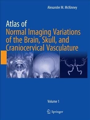 Atlas of Normal Imaging Variations of the Brain, Skull, and Craniocervical Vasculature (Paperback, Softcover Repri)