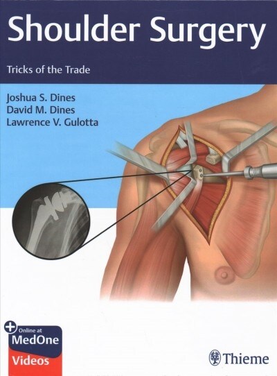 Shoulder Surgery: Tricks of the Trade (Hardcover)