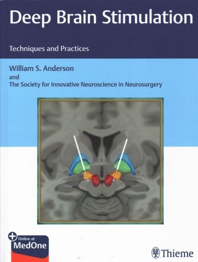 Deep Brain Stimulation: Techniques and Practices (Hardcover)