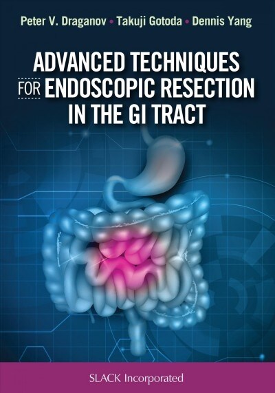 Advanced Techniques for Endoscopic Resection in the GI Tract (Hardcover)