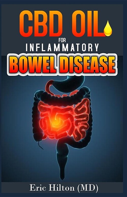 CBD Oil for Inflammatory Bowel Disease: Effective Remedy for Ibd, Using the Powerful CBD Oil and Nutrition Tips to Manage Ibd (Paperback)