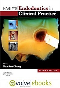 Hartys Endodontics in Clinical Practice (Package, 6 Rev ed)