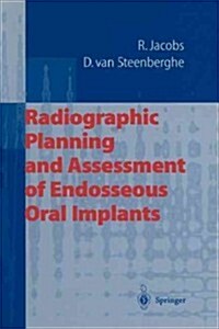 Radiographic Planning and Assessment of Endosseous Oral Implants (Paperback, Softcover Repri)