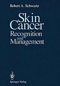 Skin Cancer: Recognition and Management (Paperback, Softcover Repri)