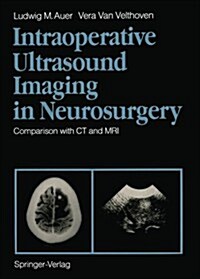 Intraoperative Ultrasound Imaging in Neurosurgery: Comparison with CT and MRI (Paperback, Softcover Repri)