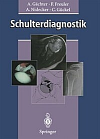Schulterdiagnostik (Paperback, Softcover Repri)