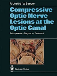Compressive Optic Nerve Lesions at the Optic Canal: Pathogenesis - Diagnosis - Treatment (Paperback, Softcover Repri)