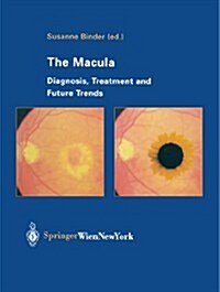 The Macula: Diagnosis, Treatment and Future Trends (Paperback, Softcover Repri)