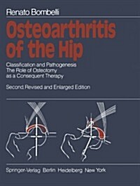 Osteoarthritis of the Hip: Classification and Pathogenesis the Role of Osteotomy as a Consequent Therapy (Paperback, 2, Softcover Repri)